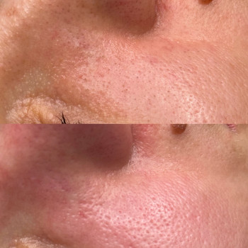 Христина Українська, Буча Фото - 60