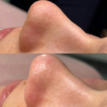 Христина Українська, Буча Фото - 58