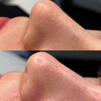 Христина Українська, Буча Фото - 34