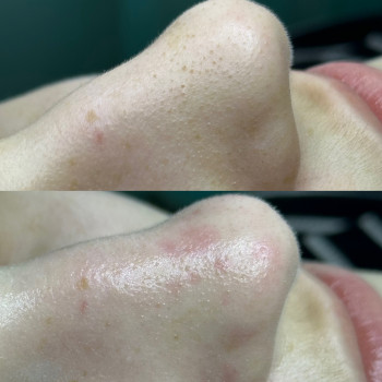 Христина Українська, Буча Фото - 5