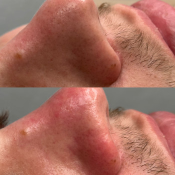 Христина Українська, Буча Фото - 8