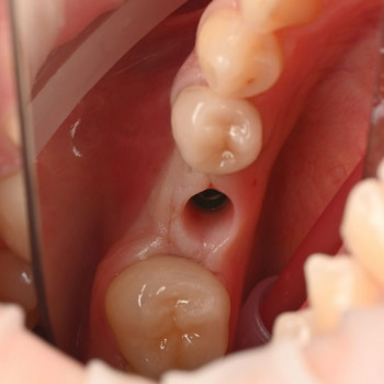 Dental Space, Ивано-Франковск Фото - 5