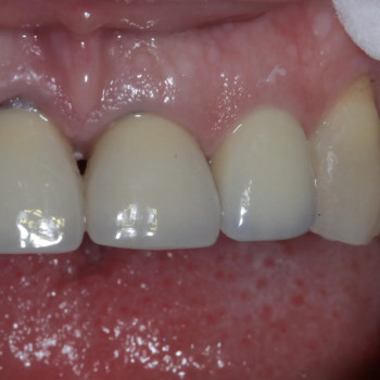 Romaniv, Ивано-Франковск Фото - 5