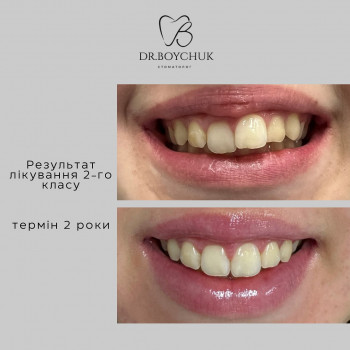 Уляна Бойчук, Ивано-Франковск Фото - 5