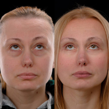 Марина Юрченко, Киев Фото - 2