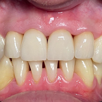 Стоматологія Майданських, Івано-Франківськ Фото - 5