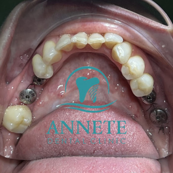 Annete Dental, Івано-Франківськ Фото - 5