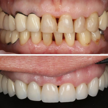 Vivcharuk Dental, Ивано-Франковск Фото - 5