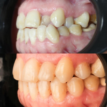 Татьяна Вивчаренко, Ивано-Франковск Фото - 5