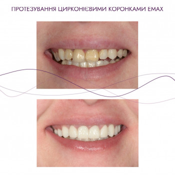 Галина Макогон, Ивано-Франковск Фото - 5