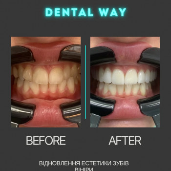 Dental Way, Кропивницький Фото - 5
