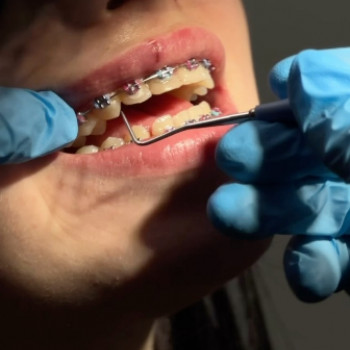 Your Ortho Family, Кропивницкий Фото - 6