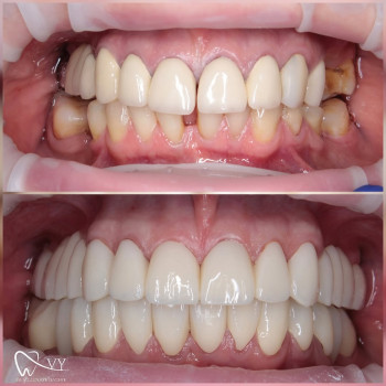 Владимир Евчик, Кропивницкий Фото - 5