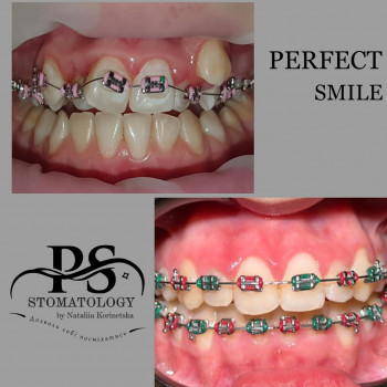 Perfect Smile, Луцк Фото - 5