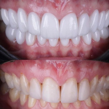 Іван Бондарашек, Луцьк Фото - 5