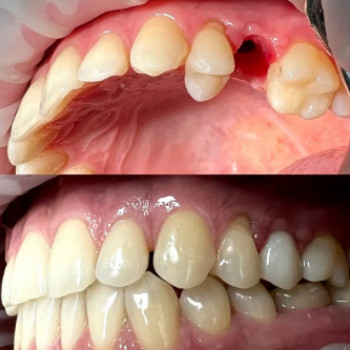 Іван Ліпич, Луцьк Фото - 5