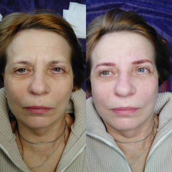 Наталия Дзюбина, Харьков Фото - 27