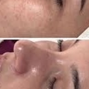 Світлана Гончарова, Бровари Фото - 6