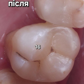 Joker Smile, Луцк Фото - 5