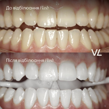 Villa Louisa, Львів Фото - 6