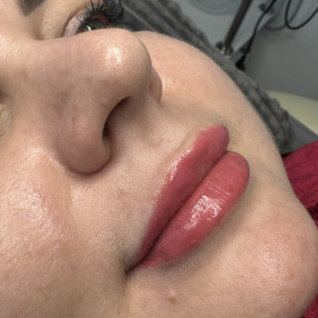 Заживші губи