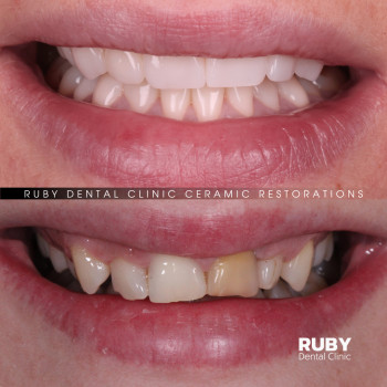 Ruby Dental Clinic, Рівне Фото - 5