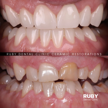 Ruby Dental Clinic, Рівне Фото - 7