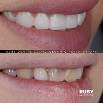 Ruby Dental Clinic, Рівне Фото - 8