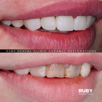 Ruby Dental Clinic, Рівне Фото - 9