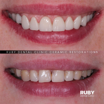 Ruby Dental Clinic, Рівне Фото - 10