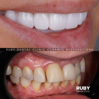 Ruby Dental Clinic, Рівне Фото - 13