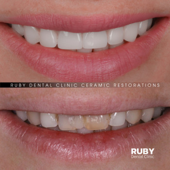 Ruby Dental Clinic, Рівне Фото - 17