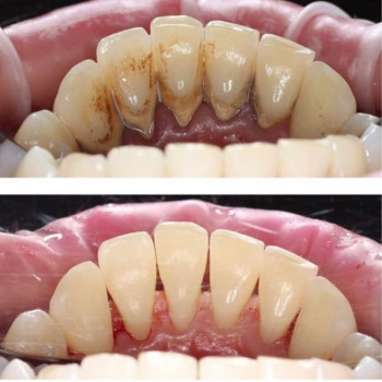 Стоматологическая клиника 1, Львов Фото - 6