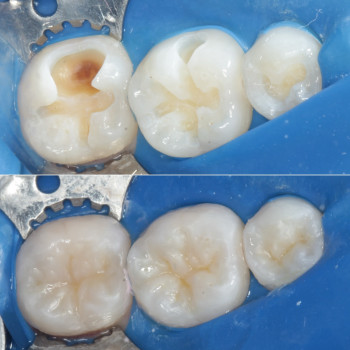 Формула Дент, Львів Фото - 5