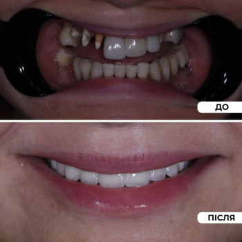 Dental Lviv, Львов Фото - 5