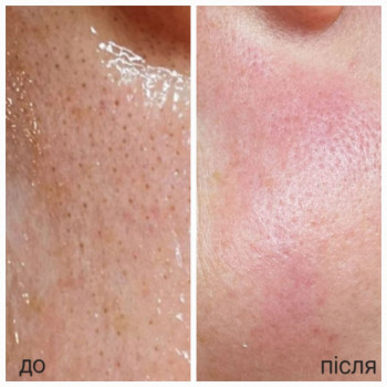 Оксана Рубльовська, Харків Фото - 2