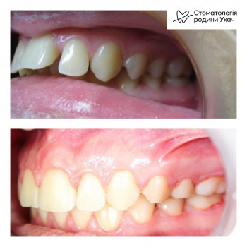 Стоматология семьи Ухач, Львов Фото - 5