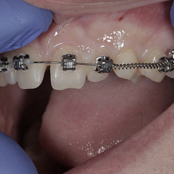 Володимир Ференц, Львів Фото - 5