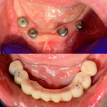 Володимир Ференц, Львів Фото - 6