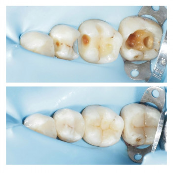 UP Dent, Львов Фото - 5