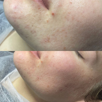 GarnaYa, Киев Фото - 4