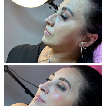 Full face - 3 мл препарату