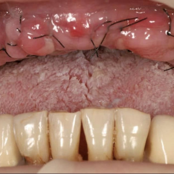 Hollywood Smile, Львов Фото - 5