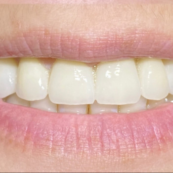 Bihan Dental Clinic, Львов Фото - 5