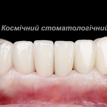 Космічний стоматологічний центр, Львів Фото - 6