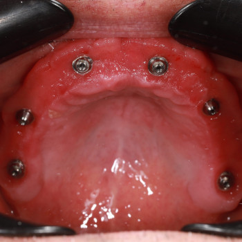 Андрей Олексюк, Львов Фото - 5