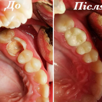 Марина Мигович, Львів Фото - 5