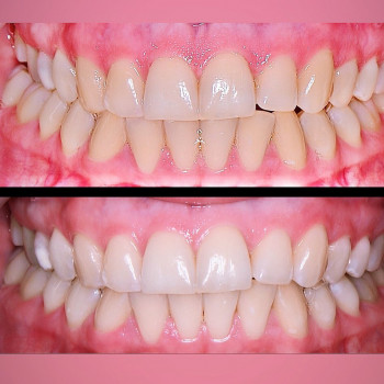 Марія Кебало, Львів Фото - 5