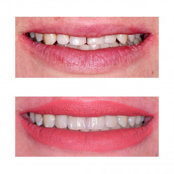 Марія Кебало, Львів Фото - 6