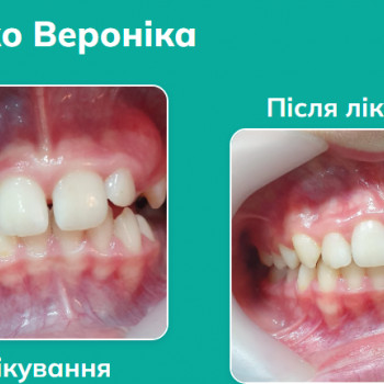 Лариса Литинская, Львов Фото - 5